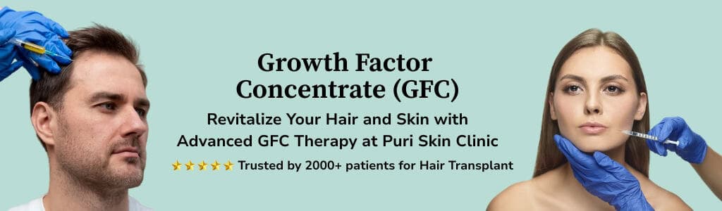 GFC Therapy Banner