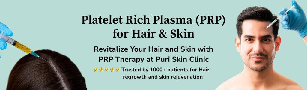 PRP Treatment Banner