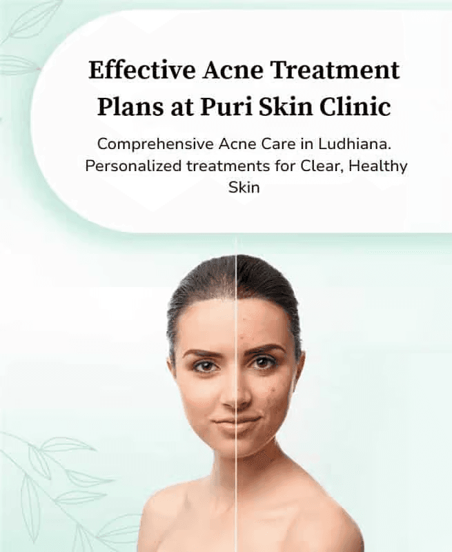 Hair Transplant Legacy northern india 1988