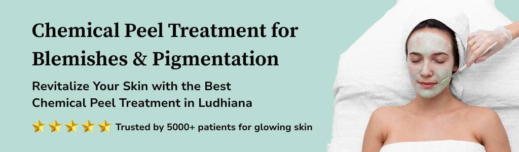 Chemical Peel Banner